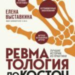 Ревматология по косточкам. Симптомы, диагнозы, лечение