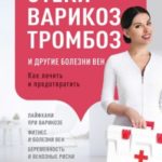 Отеки, варикоз, тромбоз и другие болезни вен. Как лечить и предотвратить
